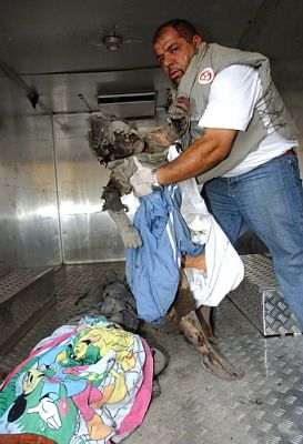 badly burnt body of young Lebanese girl with telltale signs of white phosphorous attack.