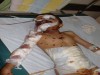 This is an Iraqi war victim. Irish children could be next. This is the reality of war and conflict. We are a part of this war with Shannon used as a US war base.