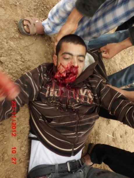 20yr old Anwar Qudai shot dead in the mouth today by israeli forces. 